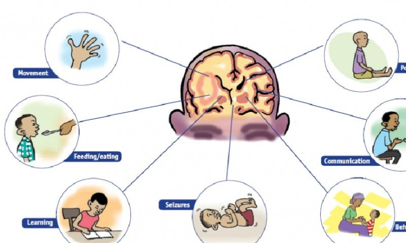 CBD and Cerabal Palsy