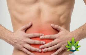 CBD and IBS (Irritable Bowel Syndrome)